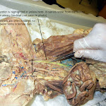 cat_ureter_L.JPG