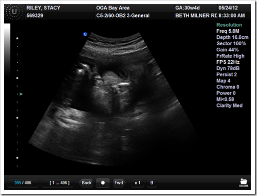 3rd TriMester 031