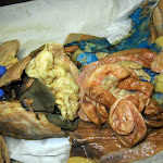 pancreatic.JPG
