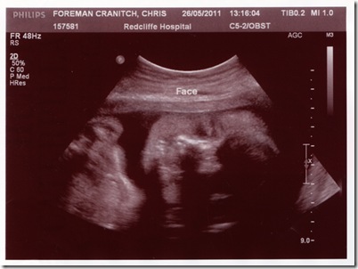 Maxie's face scan 26th may 2011_sm