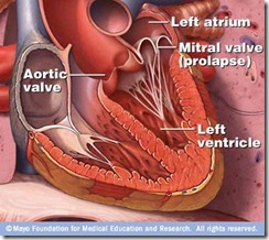 mitral-valve mitral-valve