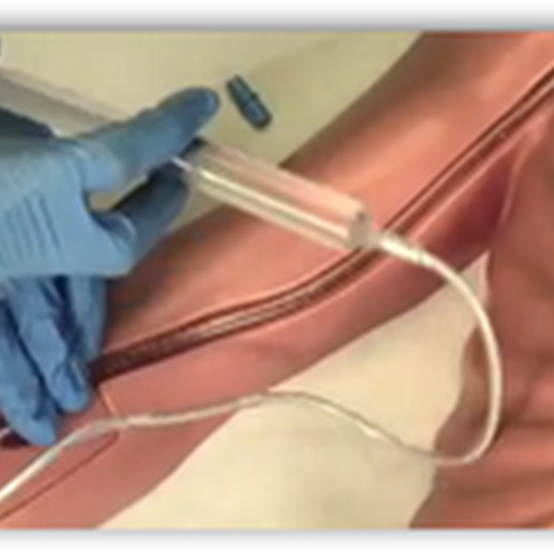 Father’s Death from Inline Staph Infection Inspires Son To Innovate and Create A FDA Approved Medical Device Without a Need for A Sterile Field To Catheterize a Heart