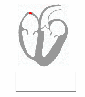 300px-ECG_principle_slow