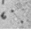StriatalNeurons.jpg