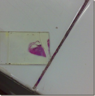stained tissue piece on slide