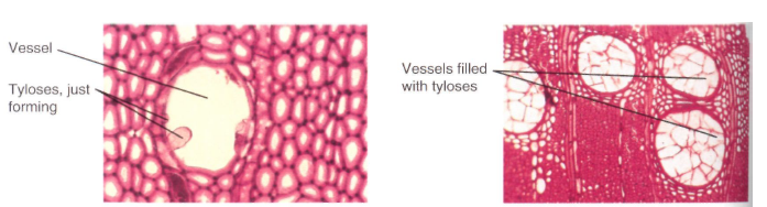 Tyloses Tyloses