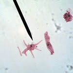 ameba03.jpg