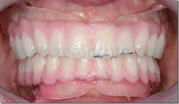 - (29) prova estetica
