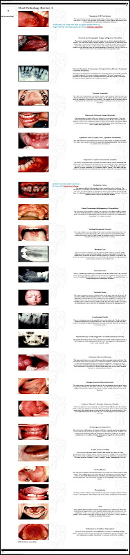 OSCE OPOM