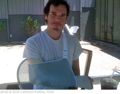 'Richard's Broken Arm' photo (c) 2009, Cameron Parkins - license: http://creativecommons.org/licenses/by/2.0/