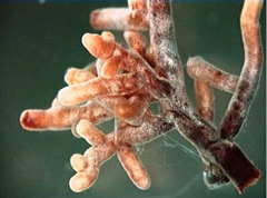 Mycorrhizal_Root_Tips