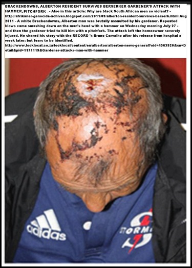 ALBERTON Brackendowns resident survives insane attack by gardener with pitchfork and hammer July272011
