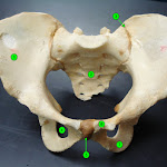 pelvis.jpg
