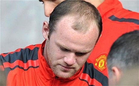 [Plan-ahead-to-combat-hair-loss%255B2%255D.jpg]