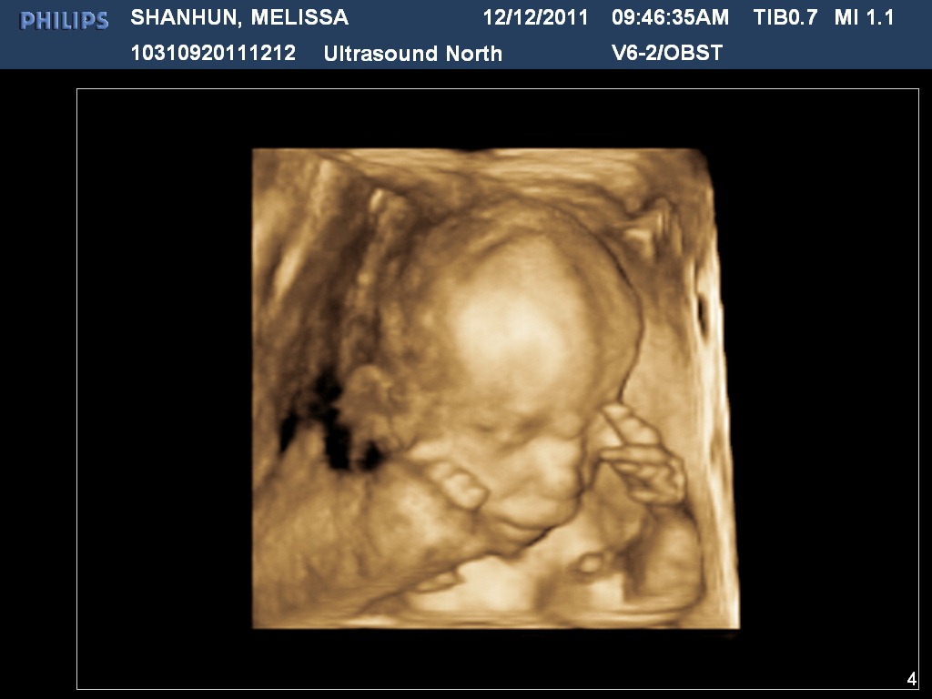 [SHANHUNMELISSA20111212094636090%255B2%255D.jpg]