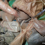 fetal_pig_aorta_labeled.jpg