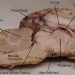 brain_dissect07.jpg brain_dissect07.jpg