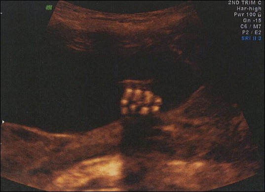 21w3