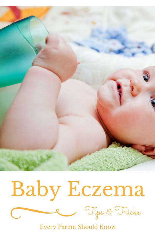 Tips and Tricks for Baby Eczema. Looking for tips and tricks to ease your baby's eczema? A mom of 4 tells you the information passed on to her by a dermatologist. Tips include what lotions were recommended along with detergent for sensitive skin. #eczema #babycare #babyskin #bathtime #FreeToBe #sp #ad Tips and Tricks for Baby Eczema. Looking for tips and tricks to ease your baby's eczema? A mom of 4 tells you the information passed on to her by a dermatologist. Tips include what lotions were recommended along with detergent for sensitive skin. #eczema #babycare #babyskin #bathtime #FreeToBe #sp #ad