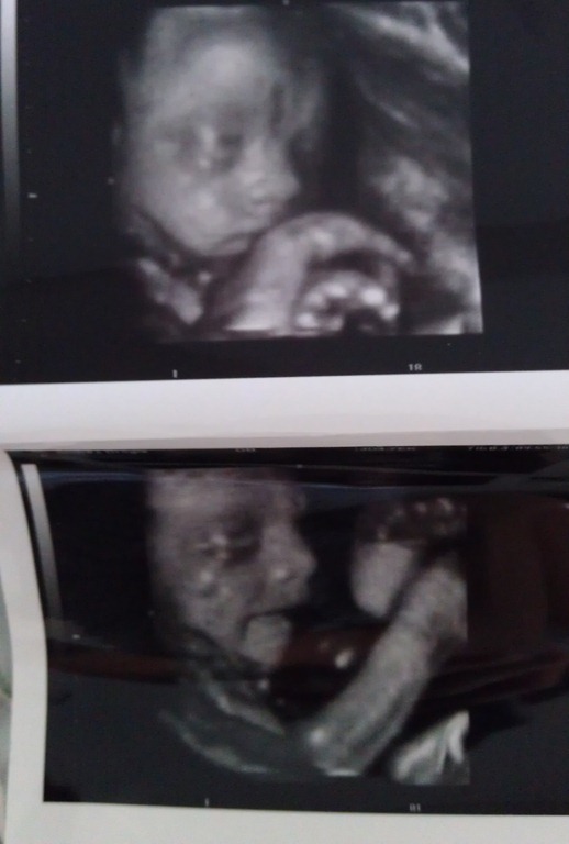 [Baby%252025%2520weeks%255B4%255D.jpg]