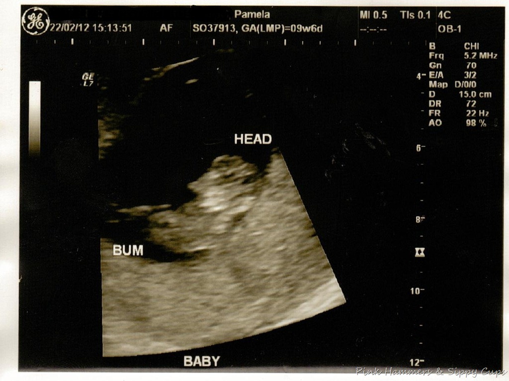 [Ultrasound2%255B11%255D.jpg]