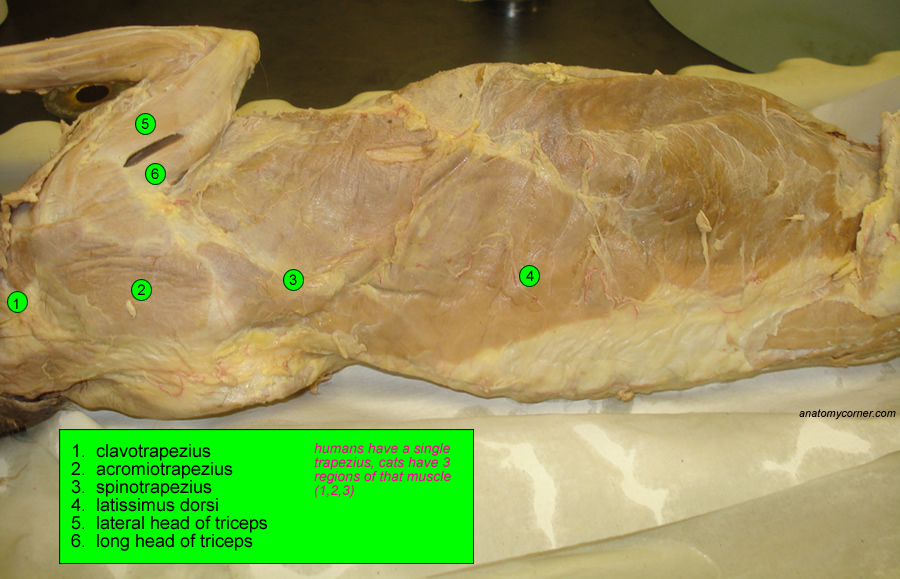 trapezius_L.jpg