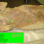 trapezius_L.jpg