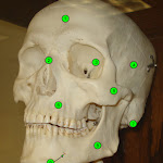 skull_anterior.jpg