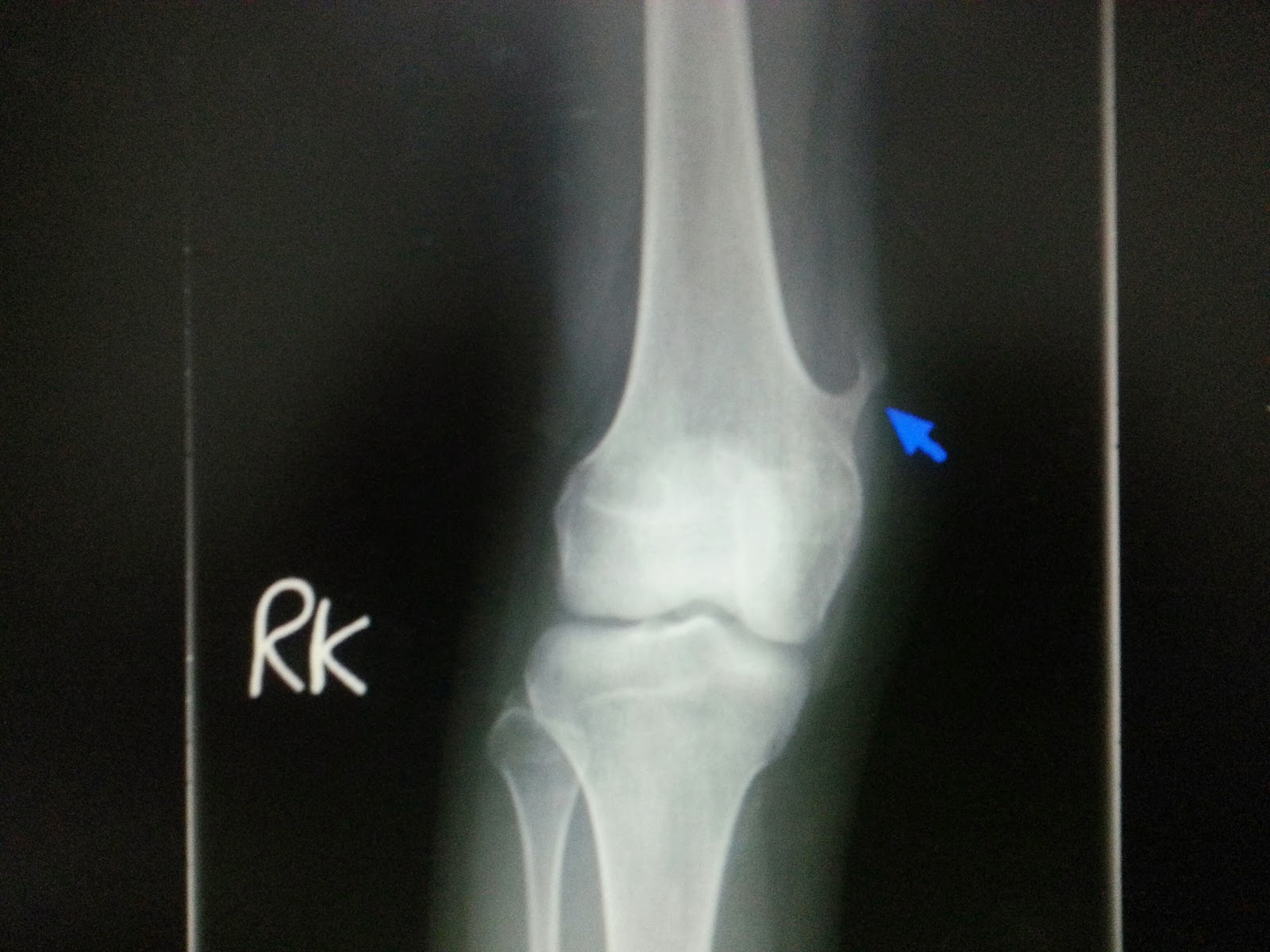 鍾承翰醫師骨科chen Han Chung M D Orthopaedic Surgeon 一月14