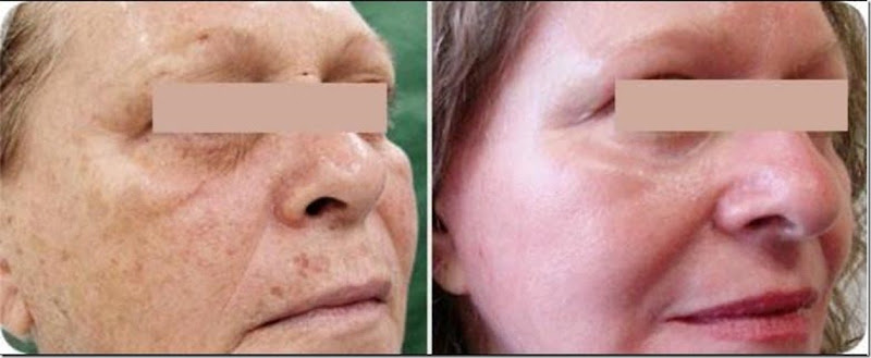 2_Jeunesse-another fantastic results of Luminesce