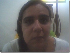 ACUPUNTURA CURITIBA PARALISIA FACIAL 1 ACUPUNTURA CURITIBA PARALISIA FACIAL 1