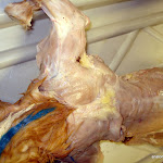 spinotrapezius.JPG