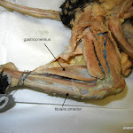 gastrocnemius_L.JPG