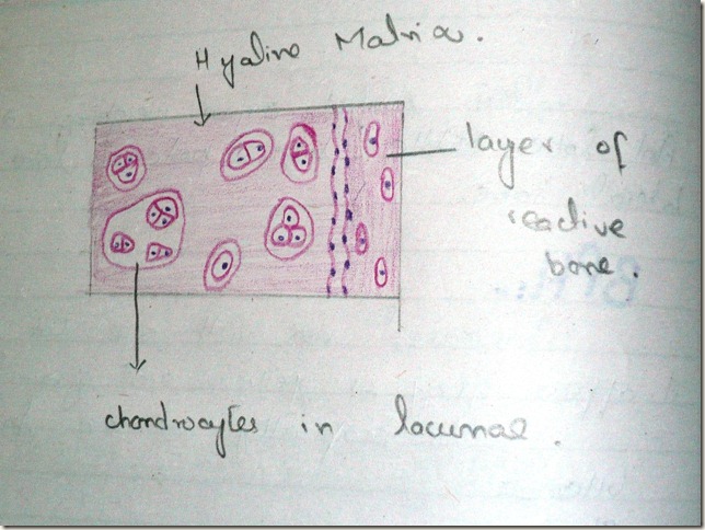 chondroma diagram histopathology