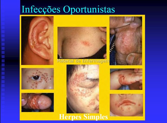 [HIV%2520e%2520Adis%255B44%255D.jpg]