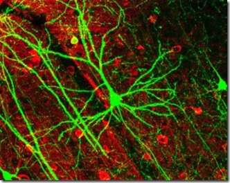 neuronas neuronas