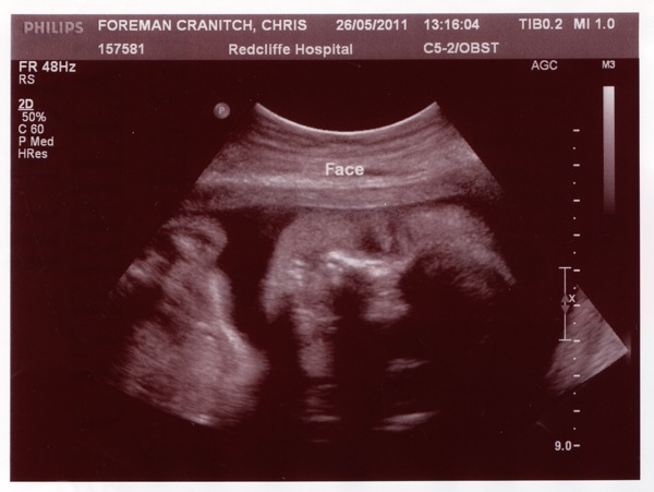 [Maxie%2527s%2520face%2520scan%252026th%2520may%25202011_sm%255B3%255D.jpg]