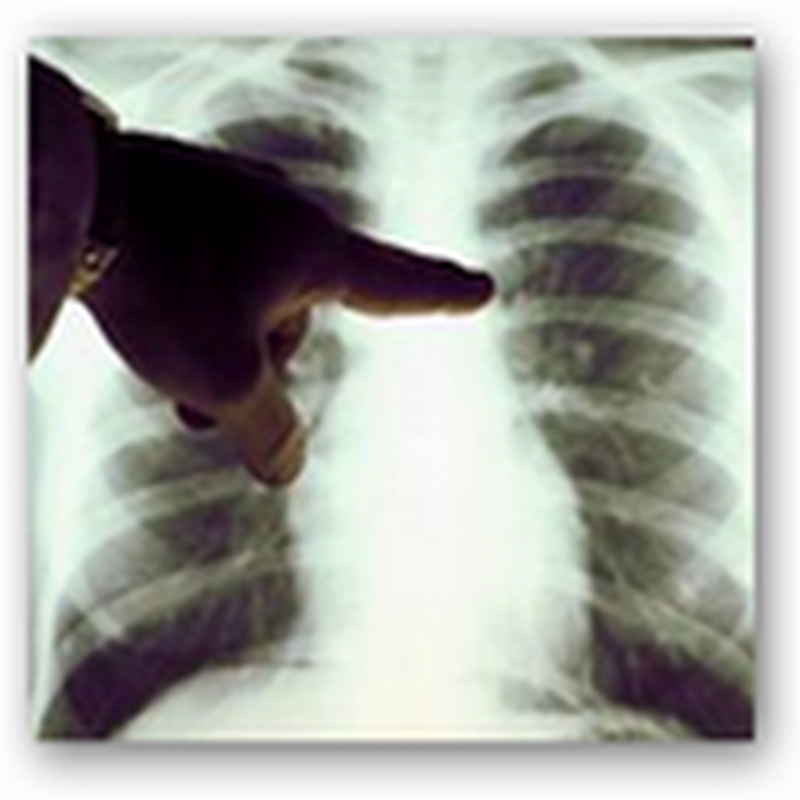 Researchers Develop Inhalation Drug Delivery System to Treat Lung Cancer