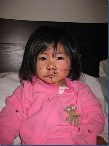 wk97_bloody_nose_sleep