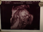 baby