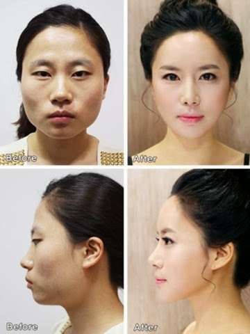 [korean-plastic-surgery-20%255B2%255D.jpg]