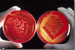 Agar plates Agar plates