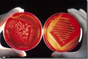 Agar plates