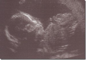 0 US 20 wk Stanley 0 US 20 wk Stanley