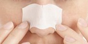 blackheads