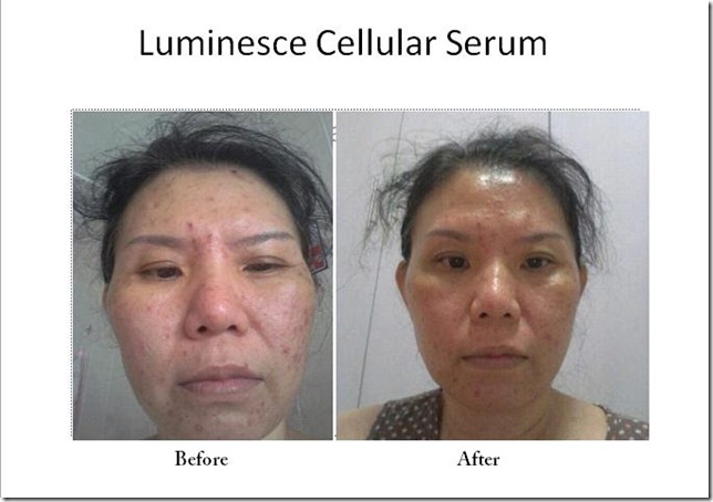 29_Serious Skin Problem BeforeAfter
