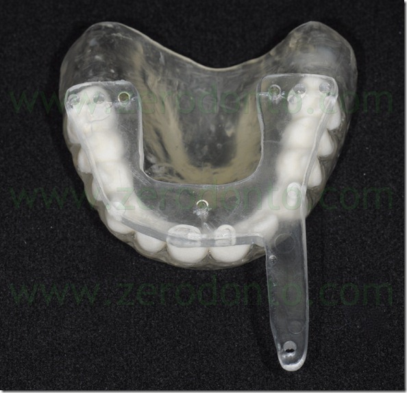 - (58) mascherina radiologica - (58) mascherina radiologica