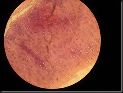 Chondroma- high resolution histology slide tsnaps Chondroma- high resolution histology slide tsnaps