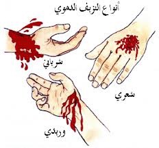 الاسعافات الاولية 2 الاسعافات الاولية 2