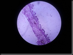 chr. cholycystitis high resolution histology slide tsnaps